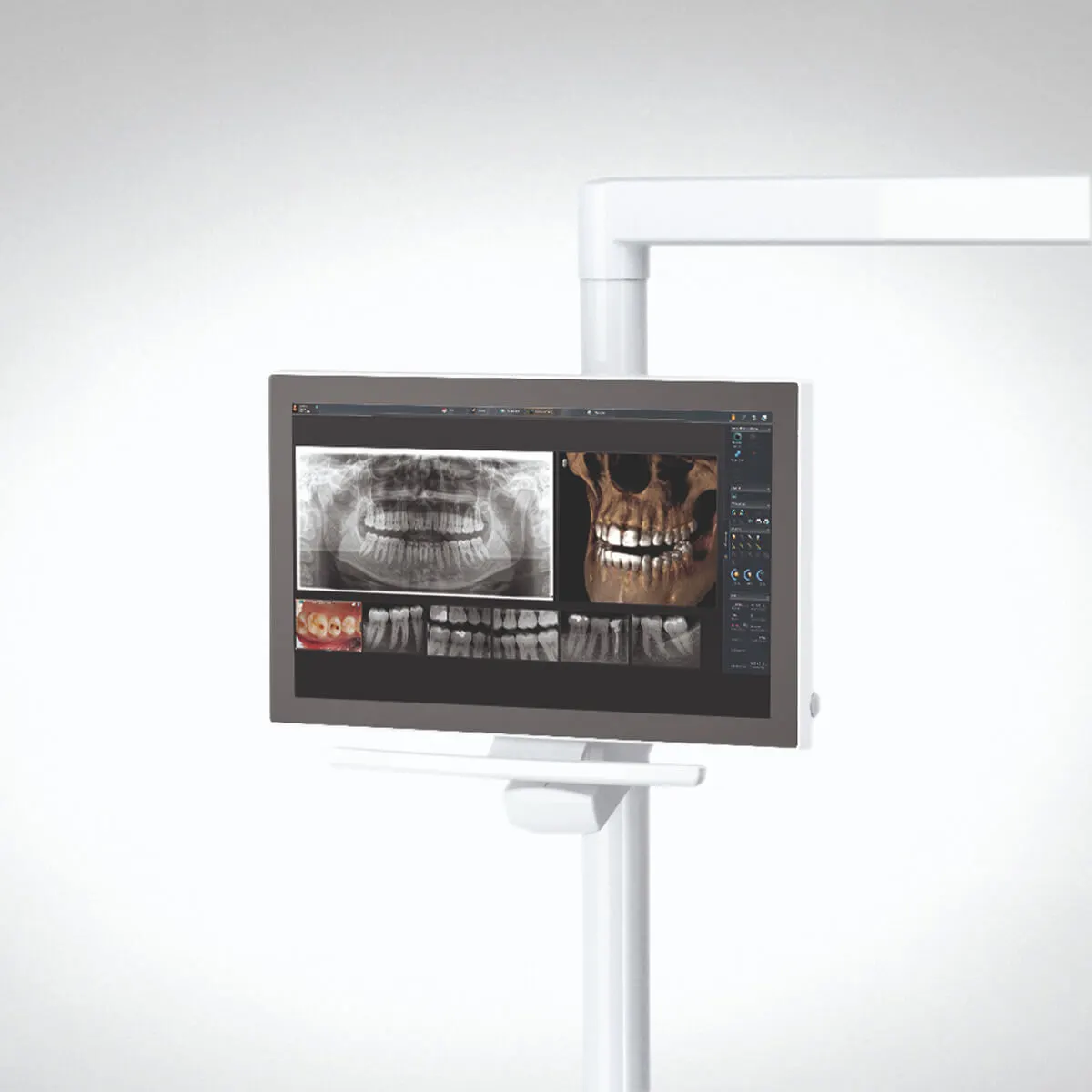 Dentsply Sirona Sinius: Kamera SiroCam AF/AF+