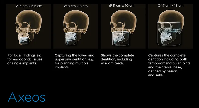 Dentsply Sirona Axeos: Szerokie spektrum obrazowania