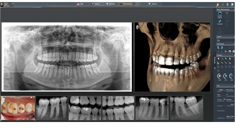 Dentsply Sirona Axeos: Integrowanie systemów diagnostycznych