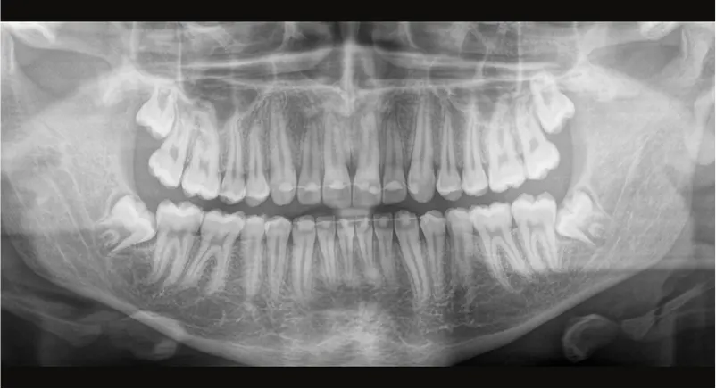Dentsply Sirona Axeos: Technologia Quickshot
