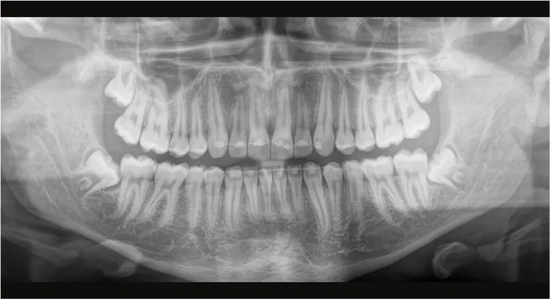 Dentsply Sirona Orthophos S 3D: Autofocus ostrości obrazu