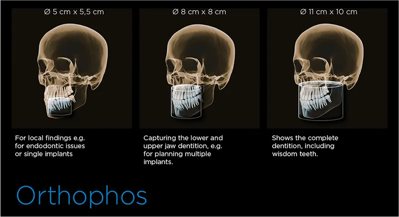 Dentsply Sirona Orthophos S 3D: Wybór obszaru obrazowania