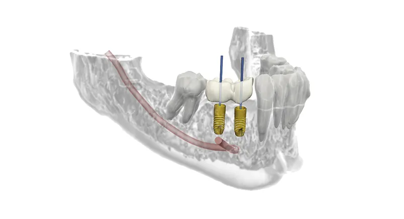 Dentsply Sirona Orthophos SL 3D: Modułowość systemu