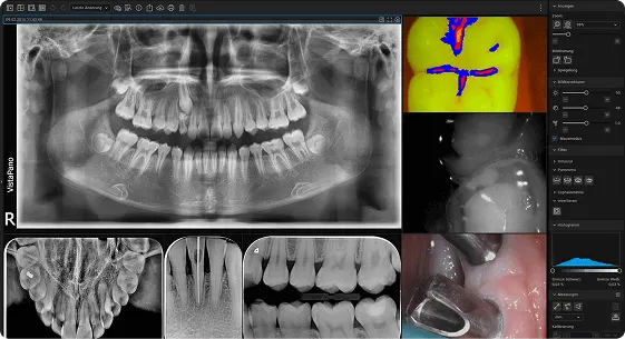 Tomograf VistaVox S 3D: Intuicyjna analiza zdjęć