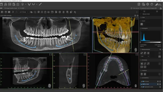 VistaScan Mini Easy 2.0: VistaSoft 3D
