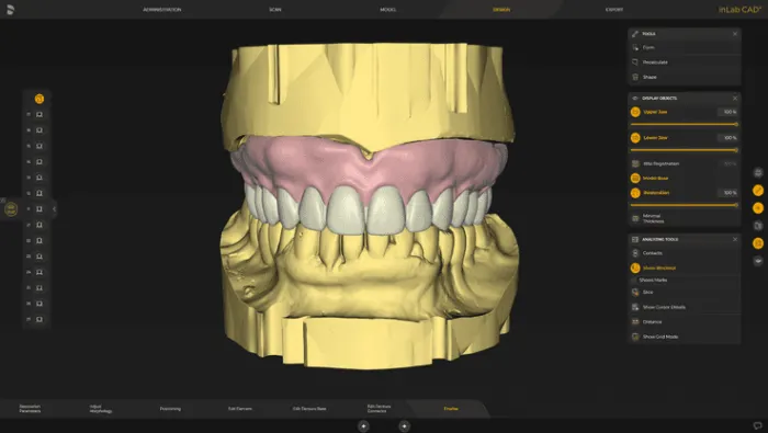 System Dentsply Sirona InLAB: Protezy wykonywane cyfrowo: Pełne jednoczęściowe