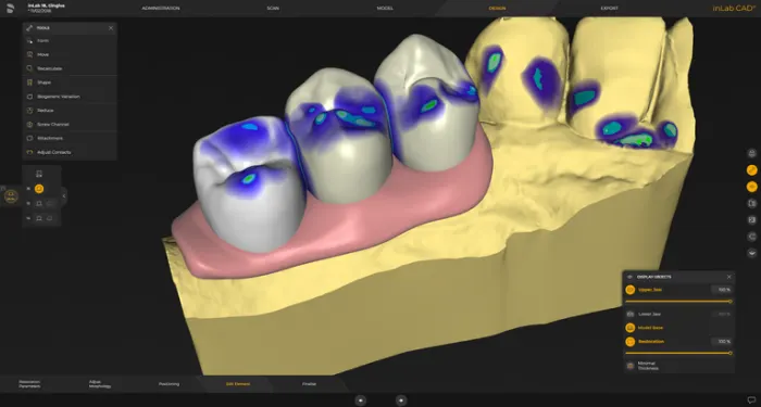 System Dentsply Sirona InLAB: Konstrukcja elementu dziąsła do wszystkich typów odbudów