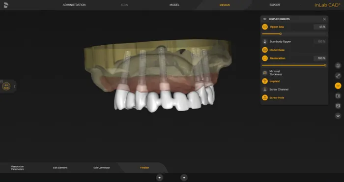 System Dentsply Sirona InLAB: Projektowanie przykręcanych mostów i belek z łącznikiem implantu