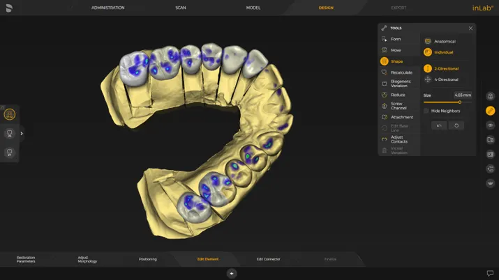 System Dentsply Sirona InLAB: J.O.B.S. - Ustawienie biogeneryczne zorientowane na szczękę