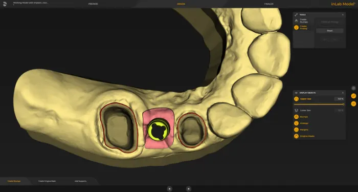 System Dentsply Sirona InLAB: Cyfrowy analog