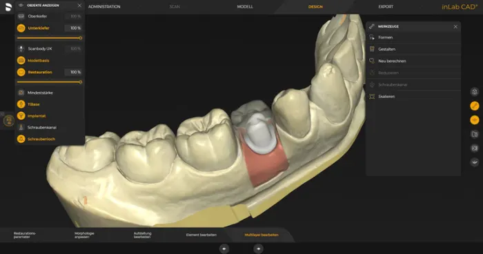 System Dentsply Sirona InLAB: Projektowanie łączników indywidualnych na TiBase i tytanowych preformach