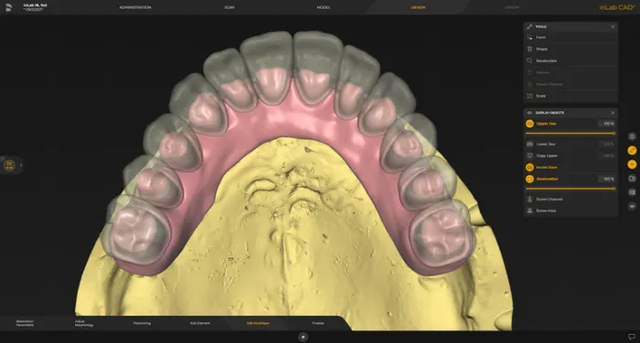 System Dentsply Sirona InLAB: Wielowarstwowe dziąsło