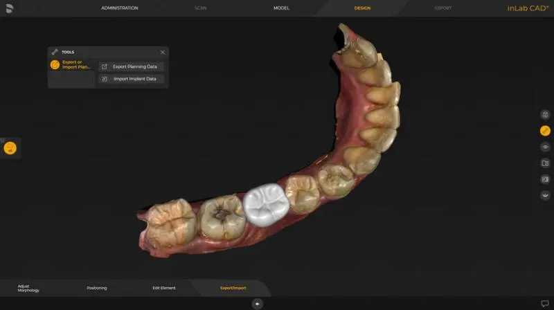 System Dentsply Sirona InLAB: Eksport danych planowania protetycznego i skanowania optycznego