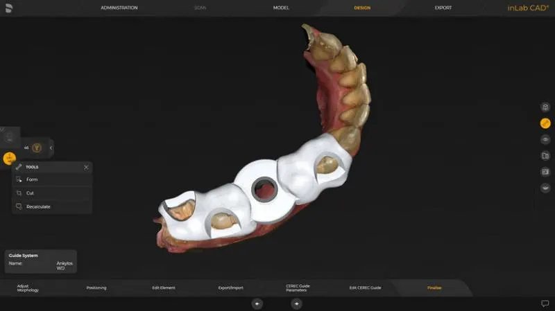 System Dentsply Sirona InLAB: Plik planowania *.cmg.dxd