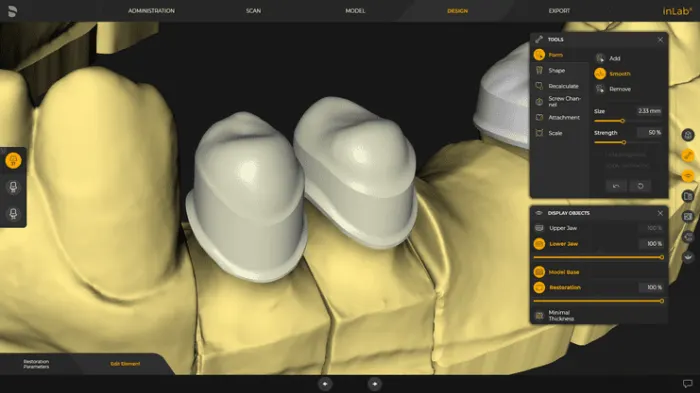 System Dentsply Sirona InLAB: Indywidualny główny teleskop i korony stożkowe