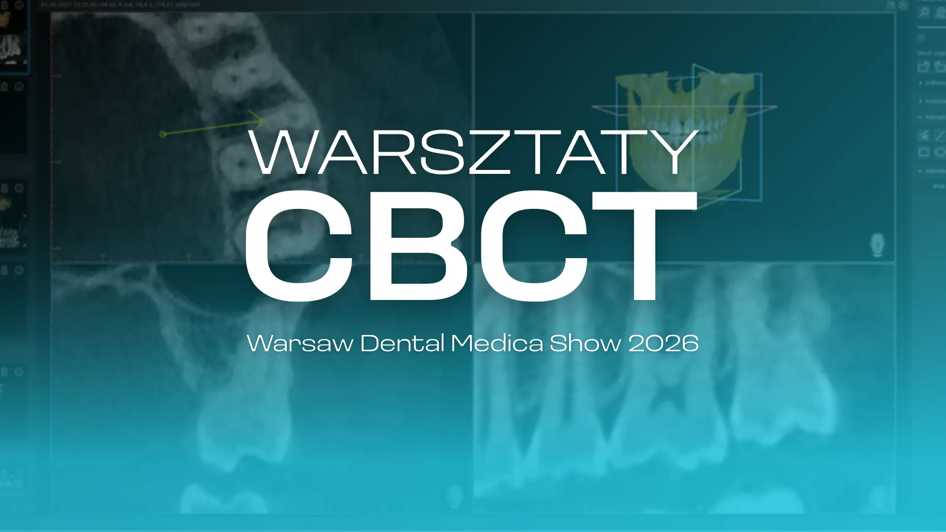 Warsztaty - Diagnostyka radiologiczna w leczeniu endodontycznym