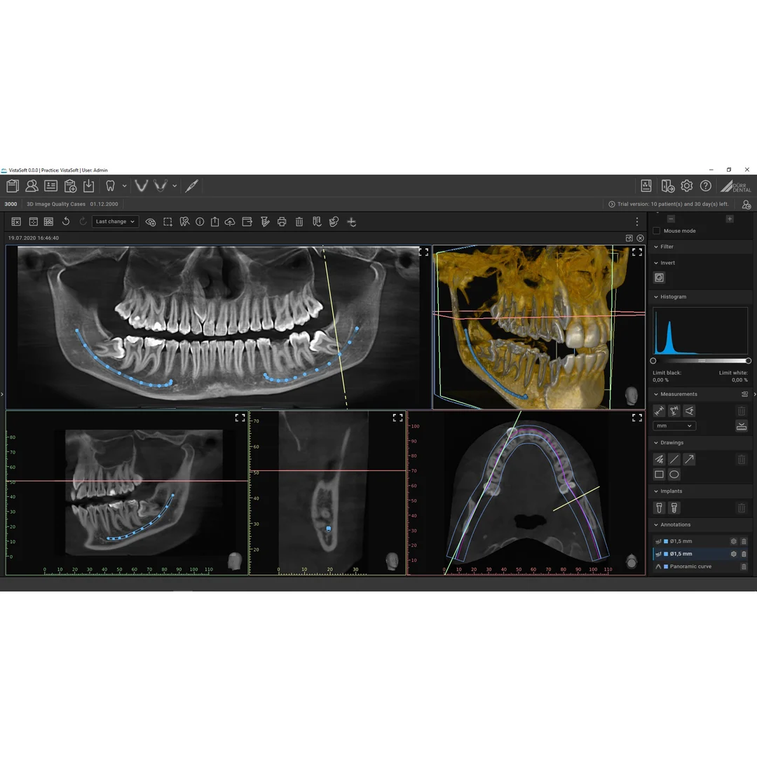 Tomograf VistaVox S 3D, zdjęcie 7